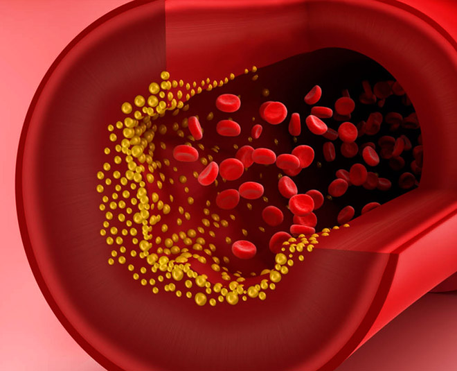 cinnamon honey for cholesterol