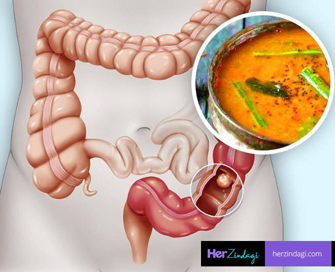 sambar colon cancer