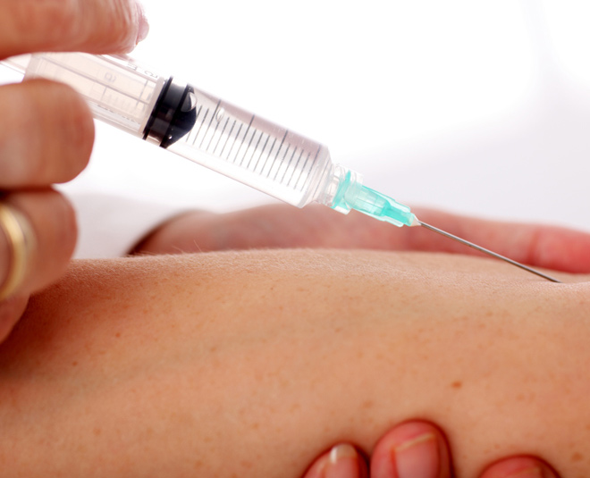 tuberculosis health inside 