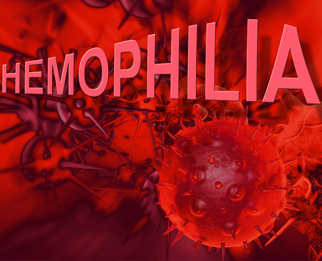 hemophilia reason