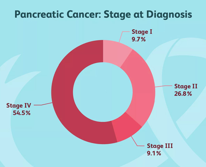 Pancreatic Cancer: The Disease That Took Away Nargis Dutt | HerZindagi