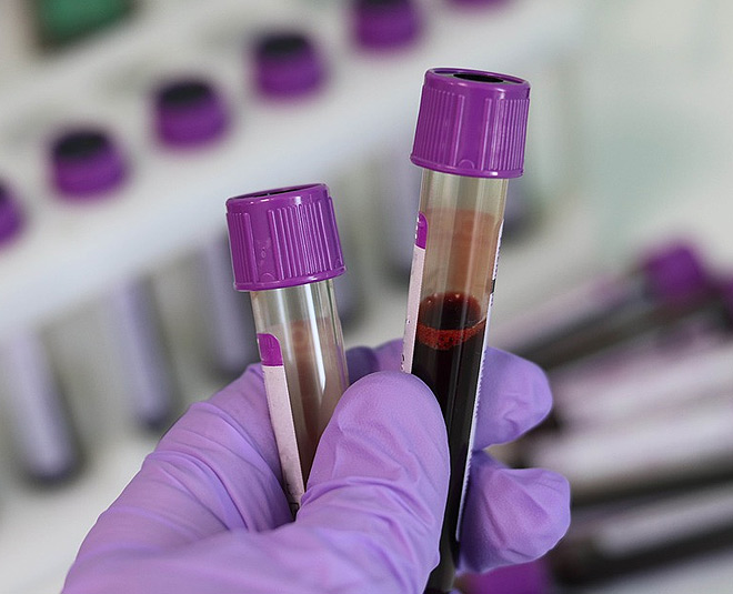 World Thalassaemia Day Here's Why Getting Blood Test Before Marriage