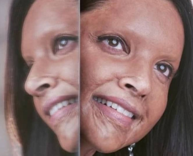 deepika padukone in chhapaak