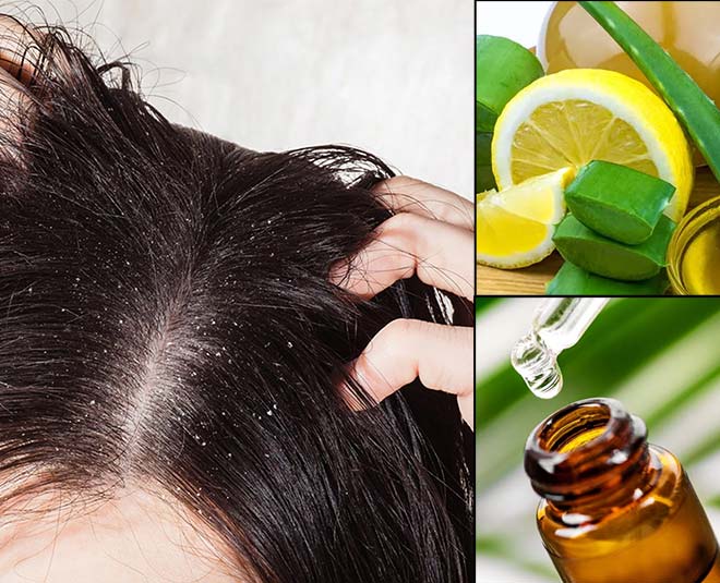 tips for oily hair Main