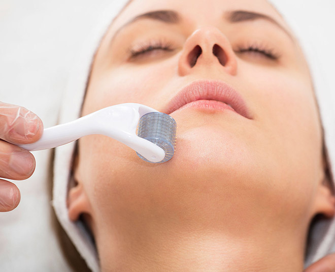 best derma roller
