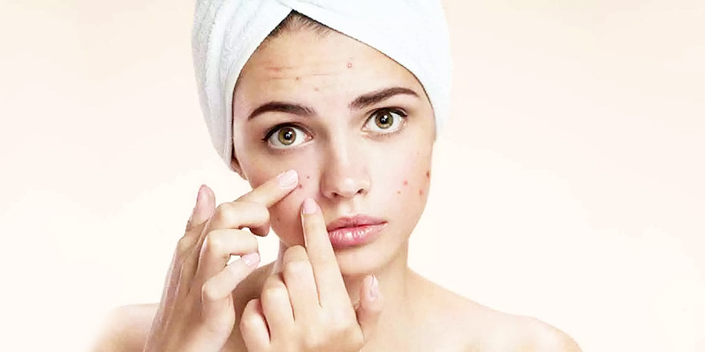 How Stress Leads to an Increase in Acne चेहरे पर कीलमुंहासे बढ़ाता है