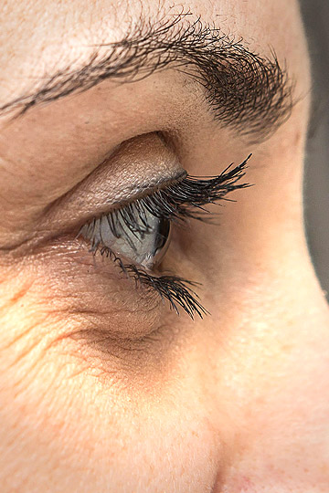 How to Get Rid of Under Eye Wrinkles with Home Remedies how to