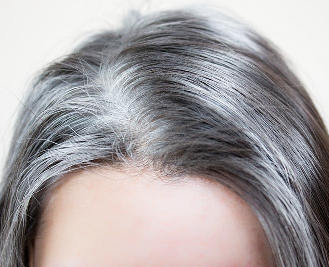 5 Reasons for Grey Hair in Young Age | 5 reasons for grey hair in young ...