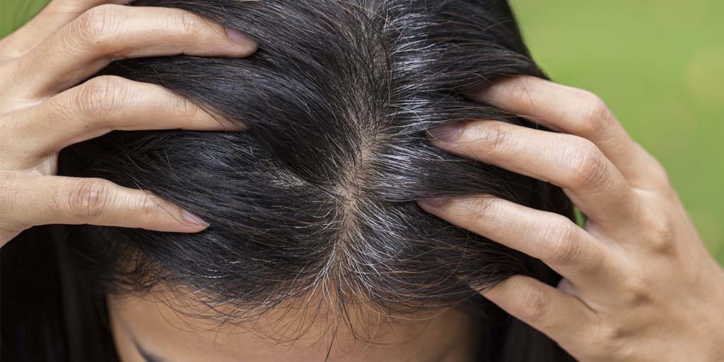Grey Hair Giving You Nightmares? These Home Remedies Will Help You Turn  Them Black | HerZindagi