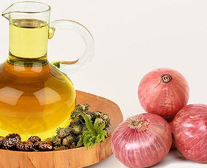 Prevent Hair Thinning Hair Fall By Using This Homemade Onion Oil