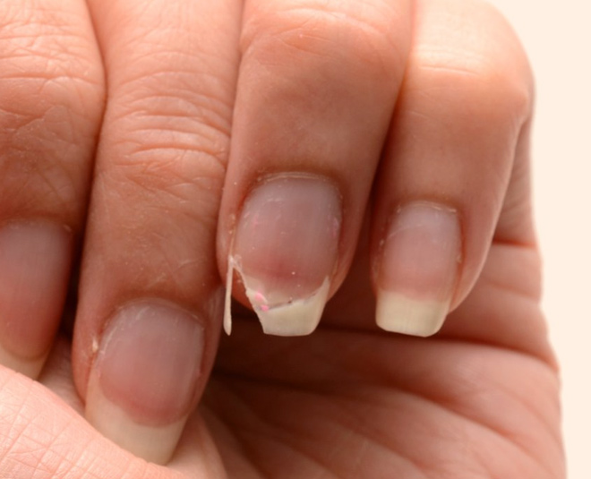 calcium deficiency health inside 