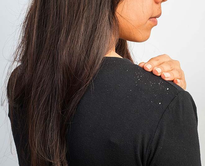 rat me baal dhone se dandruff problem inside 