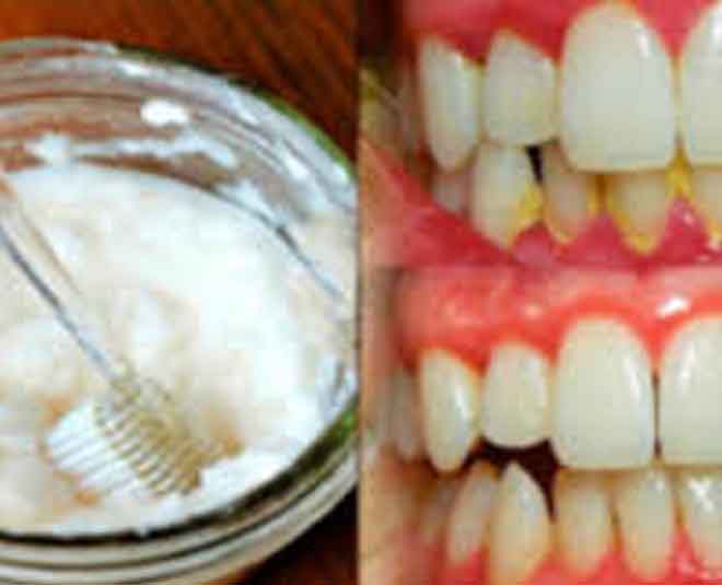 baking soda for mouth freshner