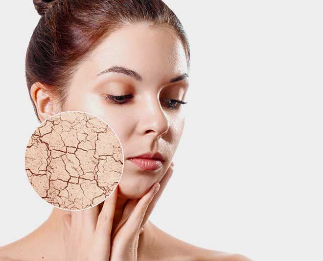 marigold face pack to get flawless skin