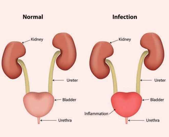 urine problem health=INSIDE