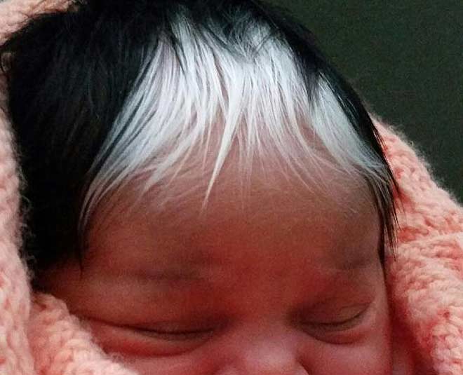 Premature Graying Or White Hair In Kids Causes  Prevention