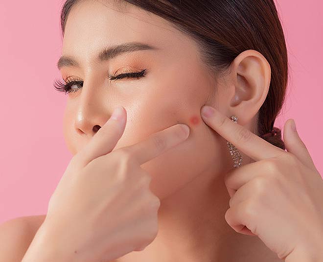 easy onion hacks for acne