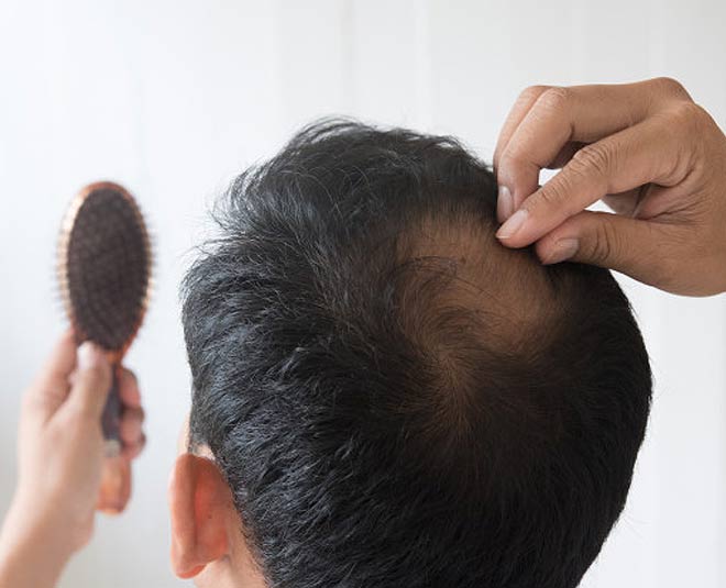 hair fall remedy inside 