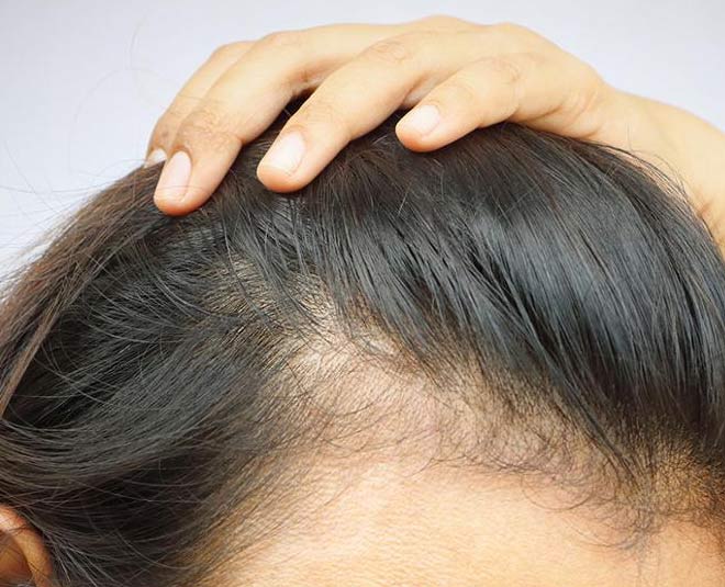 विविस्कुल bald spot inside