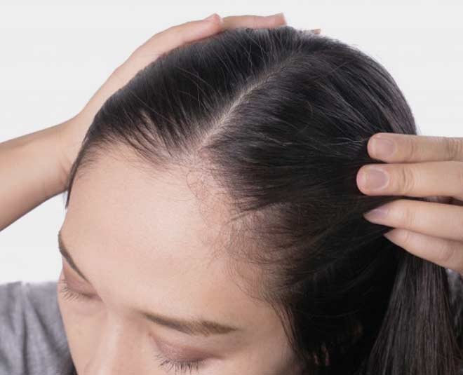 cleaning scalp without shampoo pic
