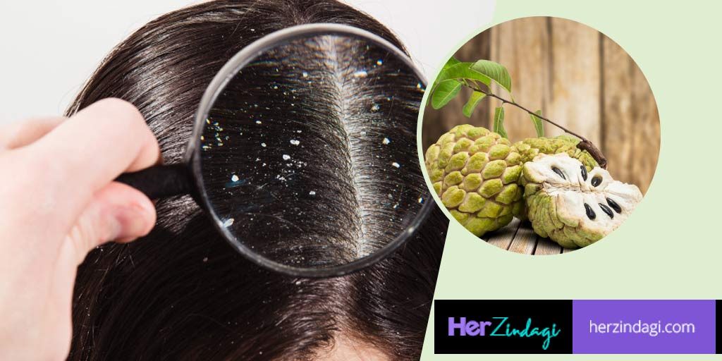 Get Rid Of Dandruff In Winter Using Snake Gourd And Custard Apple get rid of dandruff in