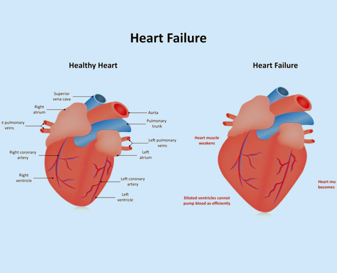 Cholesterol Check To Diabetes Not Being A Threat To The Heart: 10 Myths ...