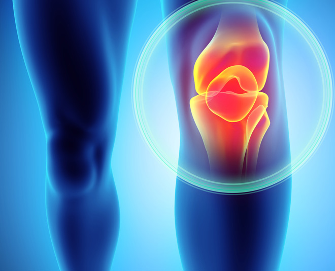 knee pain exact reason for the issue