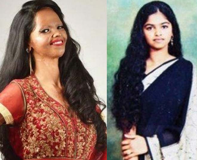 laxmi agrawal before and after images