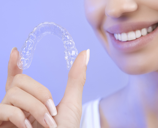 ods braces for women beautiful teeth