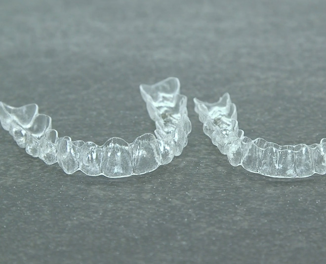 ods braces for women for perfect smile