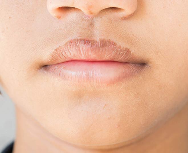 6 Food Items To Get Rid Of Dark Lips Herzindagi