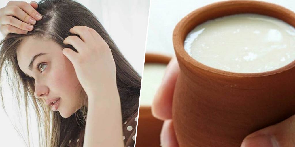 Hair Care Tips How To Use Buttermilk For Dandruff And Hair Fallझड़ते