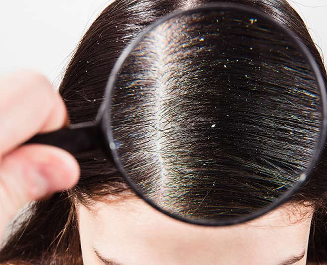 facts of anti dandruff shampoo