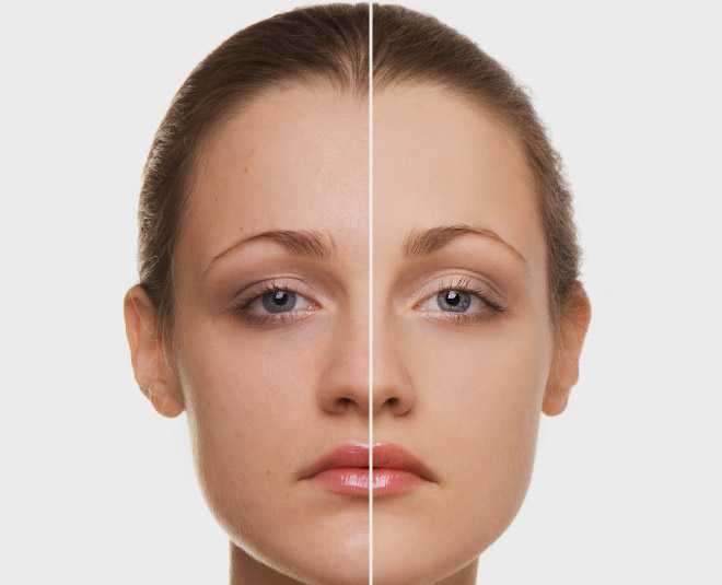 pigmentation skin problem inside 