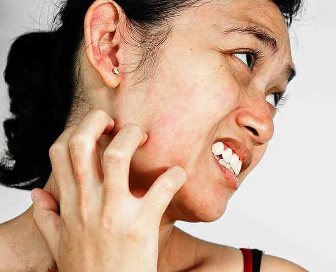 skin ingredients that can cause allergy