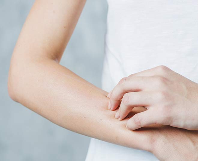 curing skin allergies with desi nuskhe