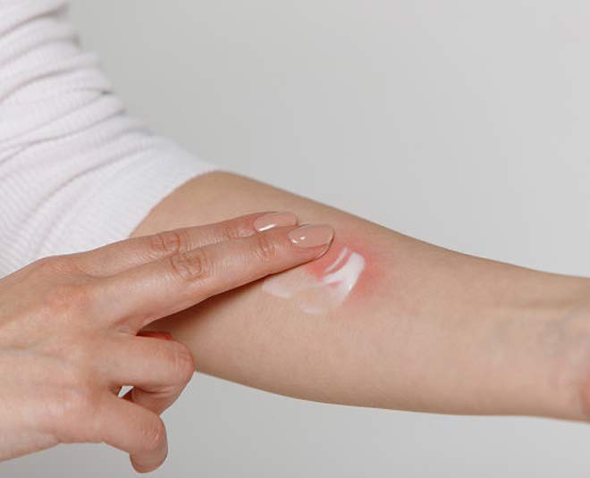 desi upay for skin allergies