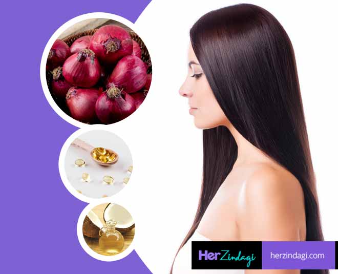 Onion Vitamin E And Coconut Oil Hair Pack To Get Rid Of Hair Fall In Hindi  | onion vitamin e and coconut oil hair pack to get rid of hair fall |  HerZindagi