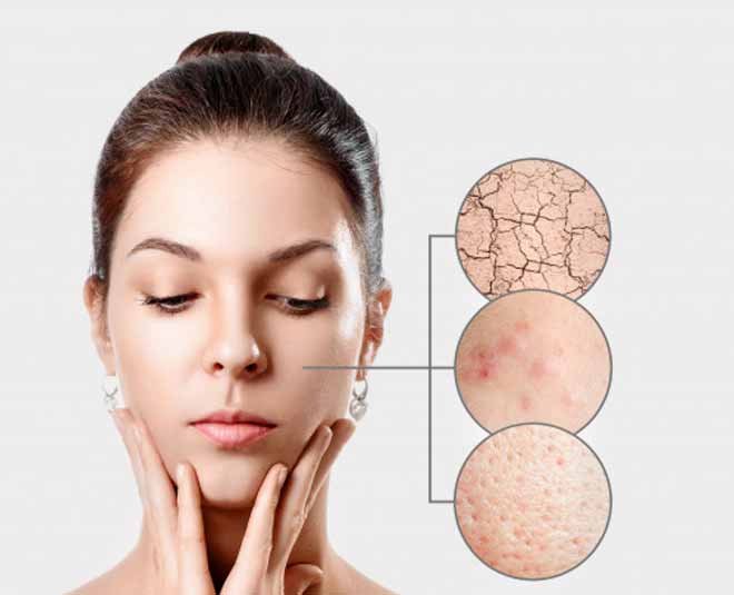 sensitive skin type facepacks