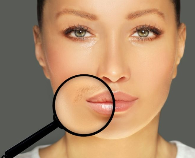 Five Easy Remedies To Remove Upper Lip Hair | HerZindagi