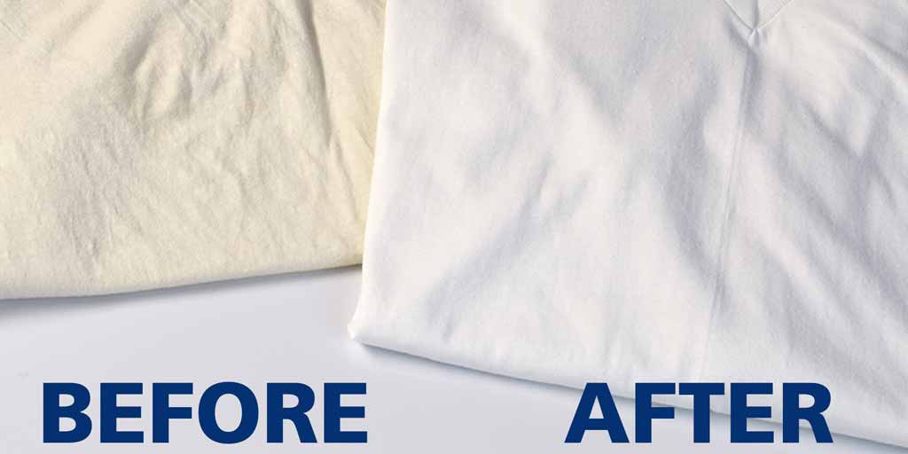 Know How To Whiten Clothes That Have Yellowed In Hindiव्हाइट कपड़ों से