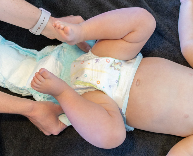 your child is allergic to diapers gets rashes inside 