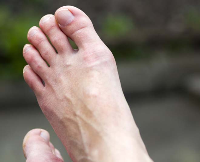 Natural remedies for on sale hard skin on feet