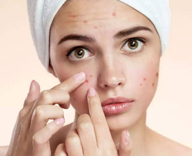 acne removal with besan