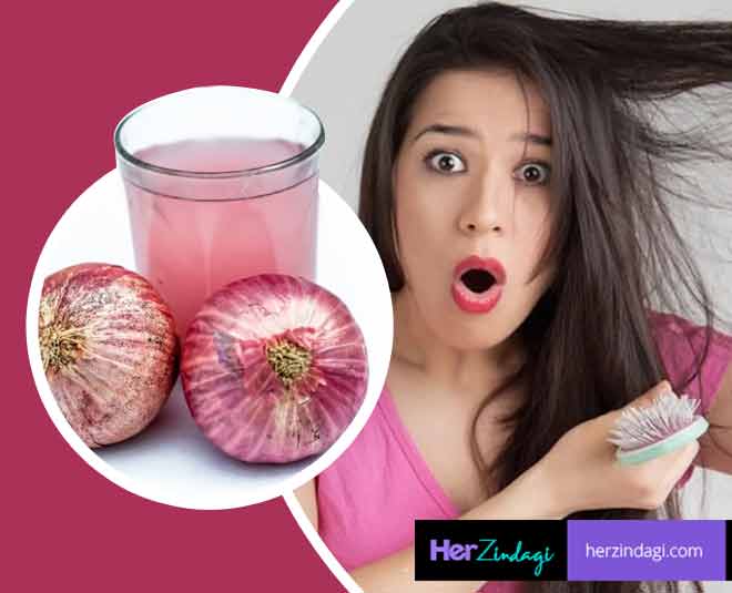 Hair Fall Control Tips: 3 Ways To Effectively Use Onion Juice For Hair Fall  | 3 ways to effectively use onion juice for hair fall | HerZindagi