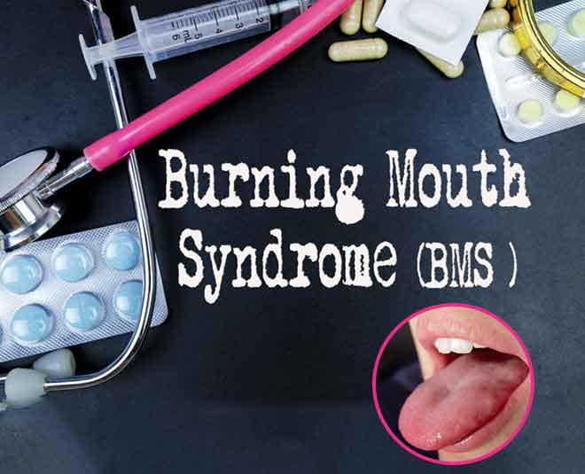 Causes Of Burning Mouth Syndrome During Menopause And Ways Of