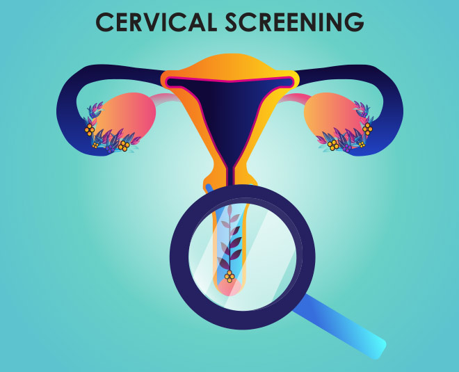 cervical cancer MAIN