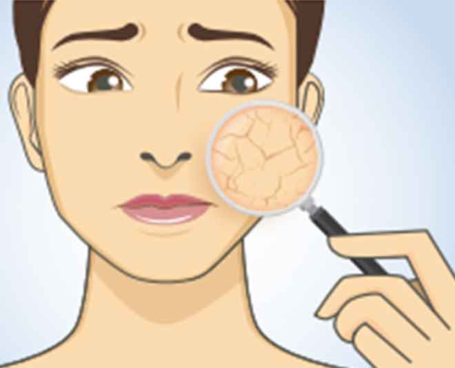 skin problem during menopause INSIDE