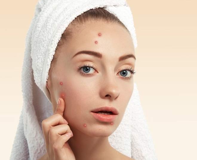 acne treatment from ragi