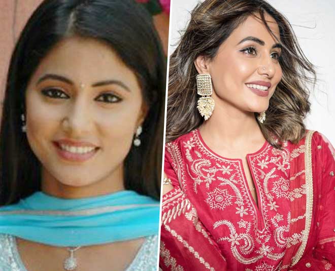 10 Bigg Boss Contestants Who Underwent Surgery To Enhance Their Beauty